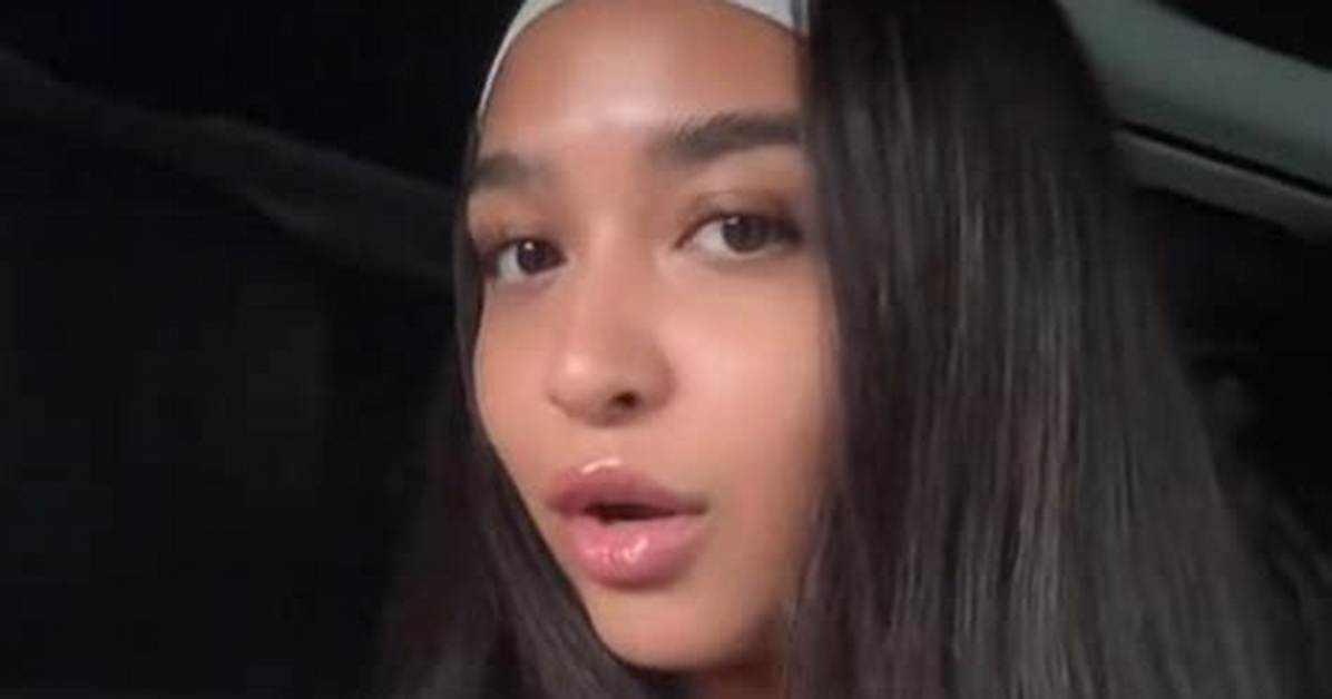 Cierra Ortega Lip Filler Dissolved: See the Before & After Photos That Went Viral
