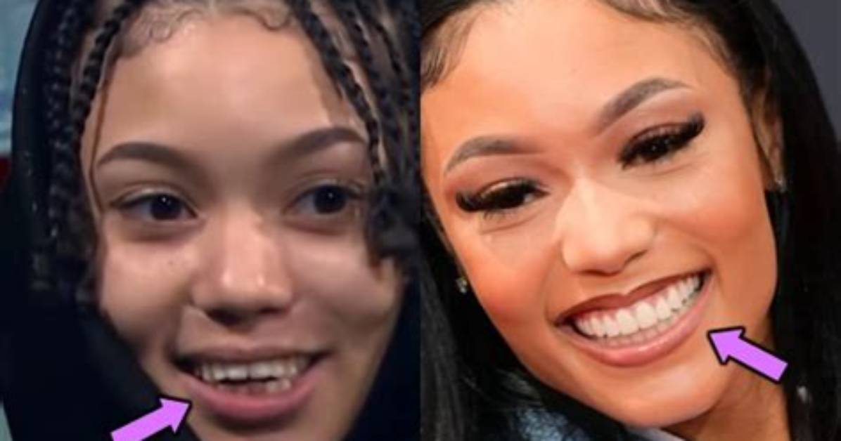 Coi Leray Before and After Breast Augmentation: Visual Breakdown and Viral Moments