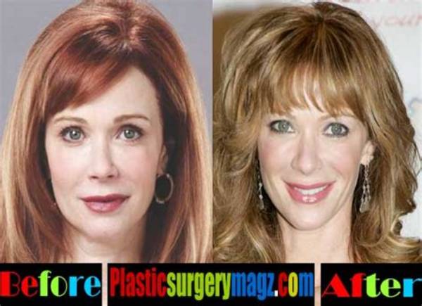 Did Lauren Holly Have Plastic Surgery? the Truth Behind the Star's Ageless Look