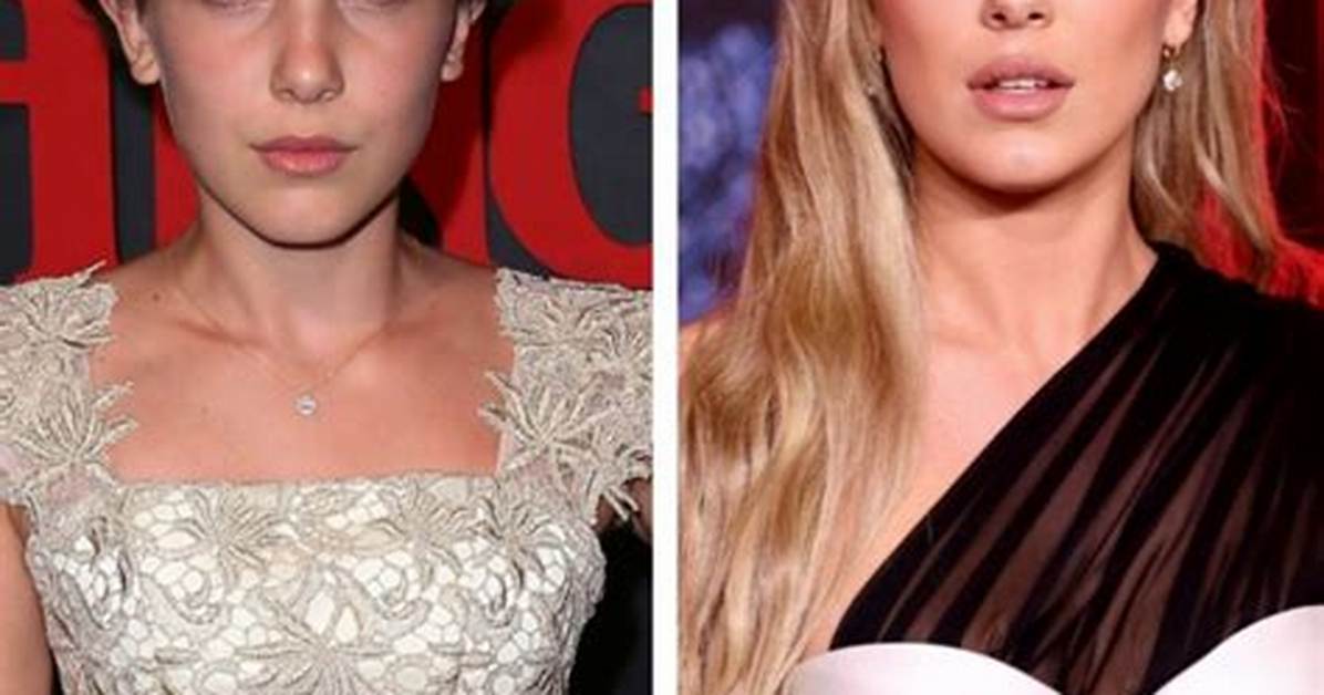 Did Millie Bobby Brown Get Plastic Surgery? Experts Break Down Natural Aging Rumors
