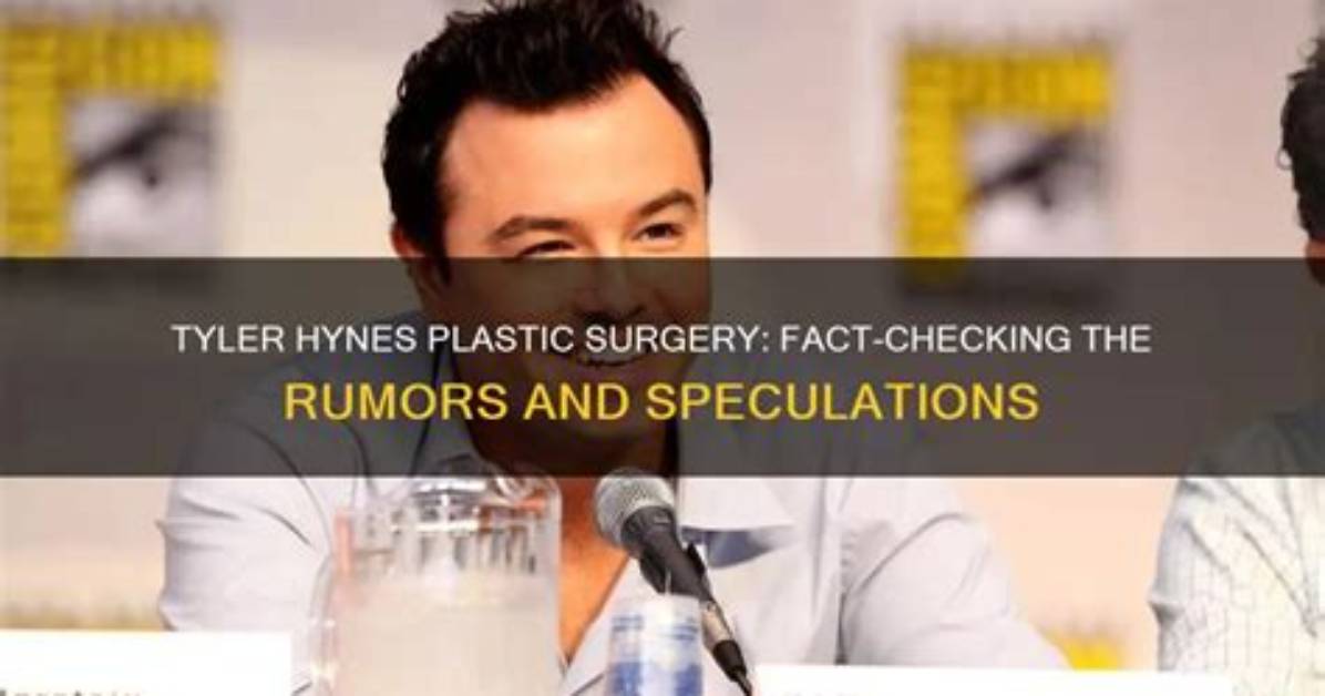 Fact-Check: Dissecting Rumors About Tyler, the Creator's Alleged Hidden Tattoos