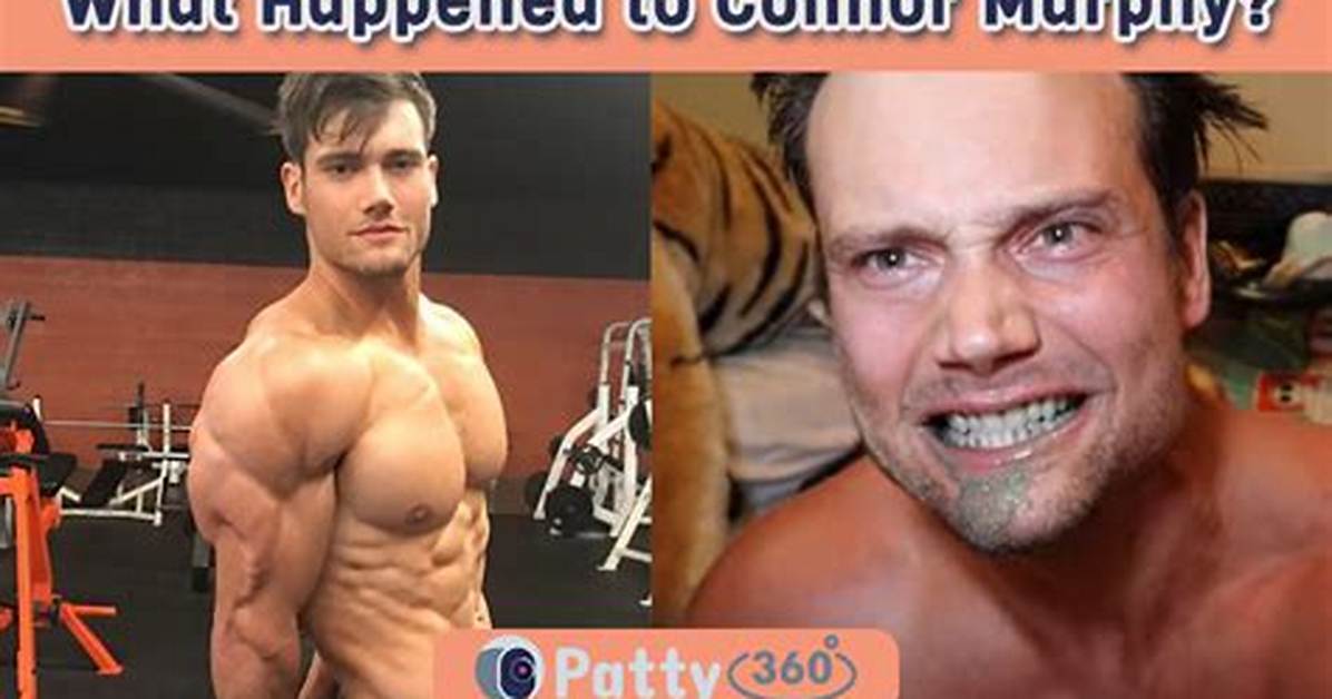 Fact-Checking Connor Murphy's Stomach Scar Rumors Following Tragic Passing in Thailand