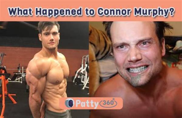 Fact-Checking Connor Murphy's Stomach Scar Rumors Following Tragic Passing in Thailand
