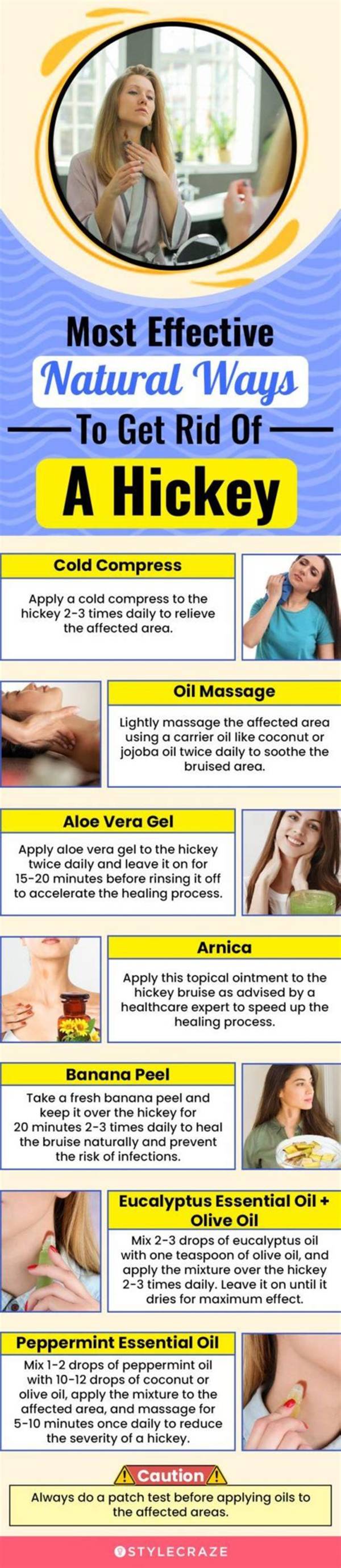 How to Get Rid of a Hickey Fast: Proven Home Remedies and Concealing Tricks