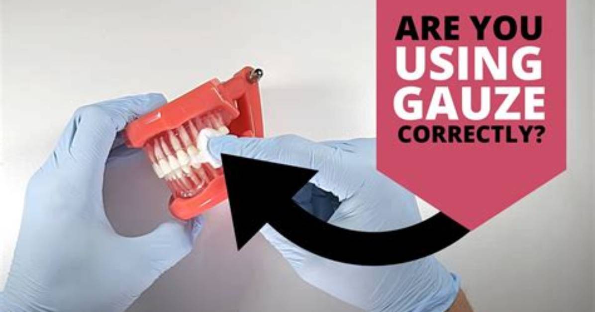 How to Put Gauze in Wisdom Teeth Sockets: Complete Step-by-Step Home Guide