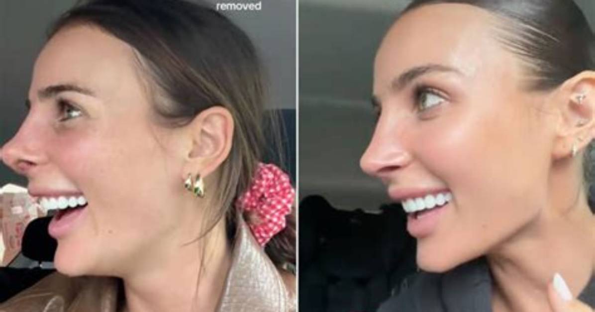 Indy Clinton's Nose Job Journey Explained: from Secret Surgery to Viral Internet Sensation