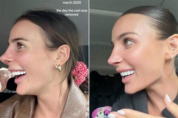 Indy Clinton's Nose Job Journey Explained: from Secret Surgery to Viral Internet Sensation