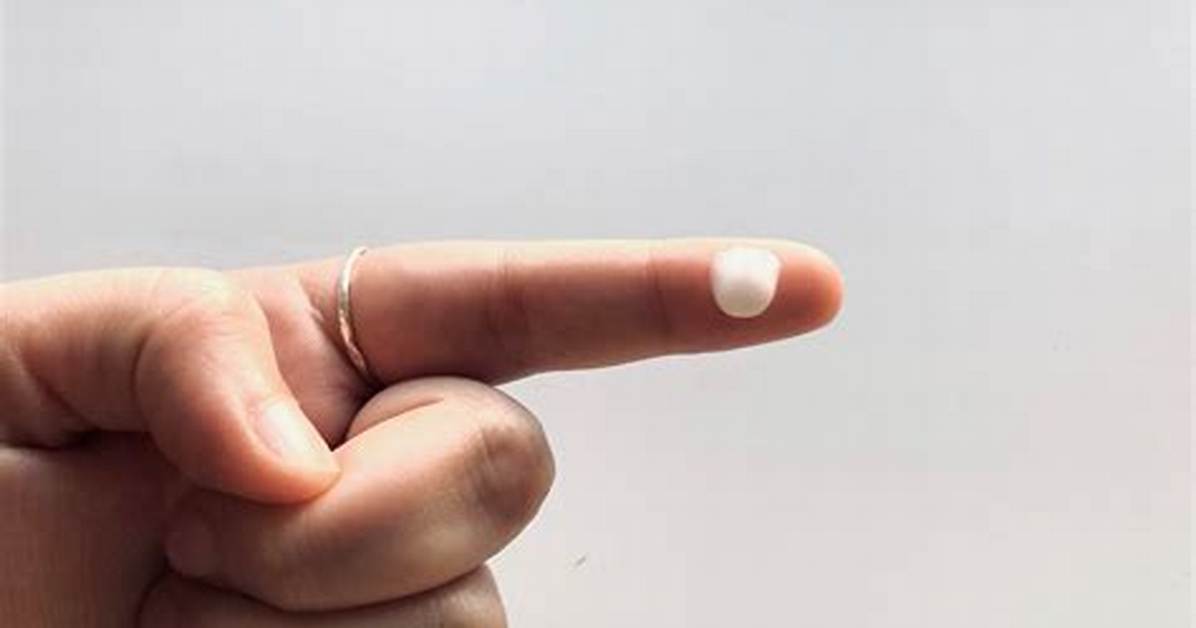 Is a Pea-Sized Amount of Tretinoin Really Enough for Your Whole Face?