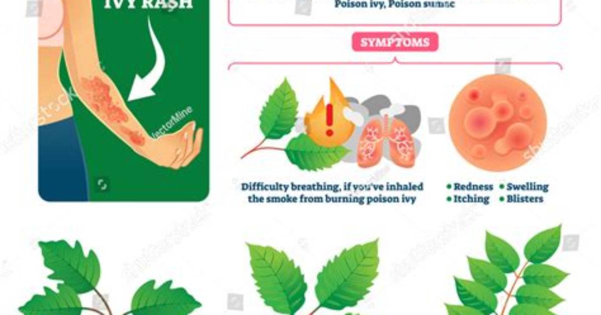 Is It Really Poison Ivy in Your Grass? Visual Guide to Spotting the Secret Invader