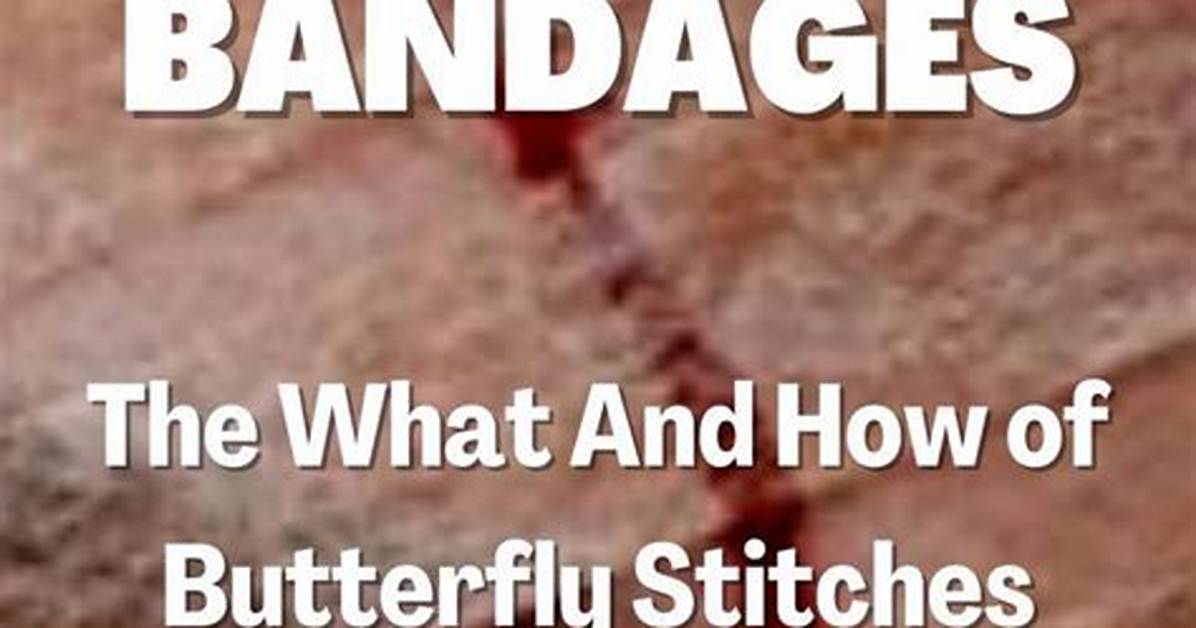 Skip the Er? When Butterfly Stitches Can Safely Replace Costly Hospital Visits