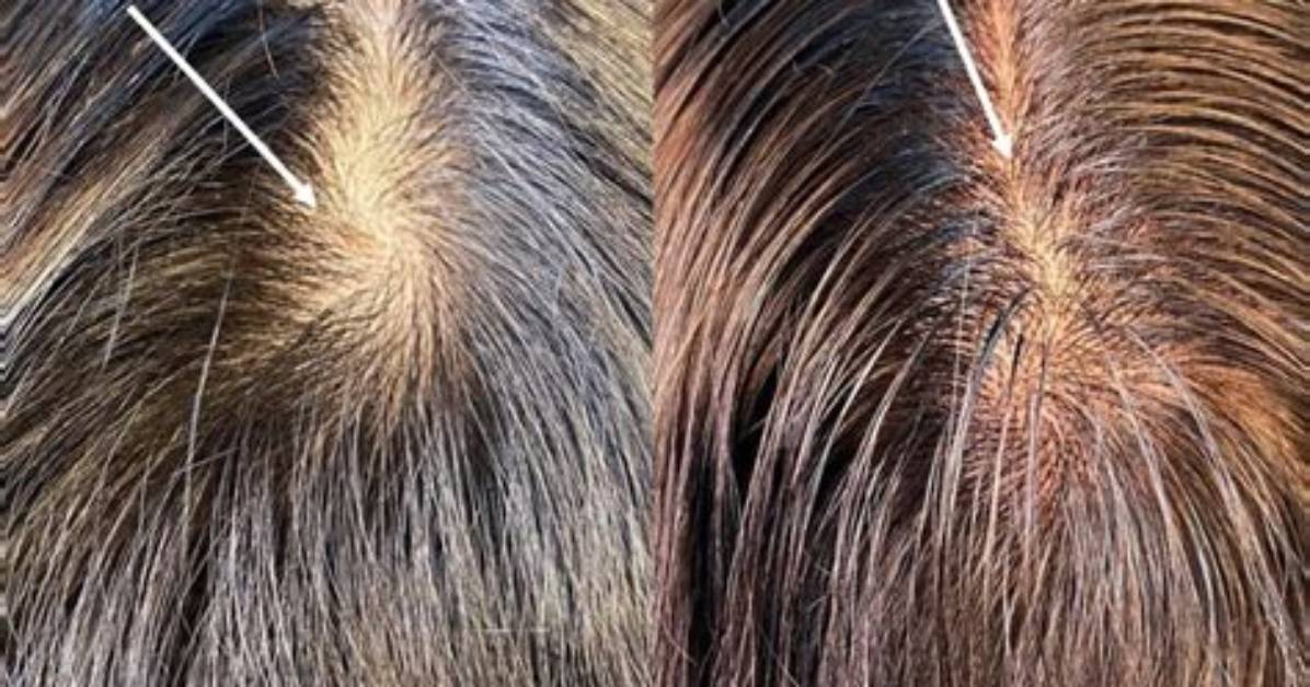 Stop Fighting Your Cowlick: the Haircut Mistake Making It Look 10X Worse