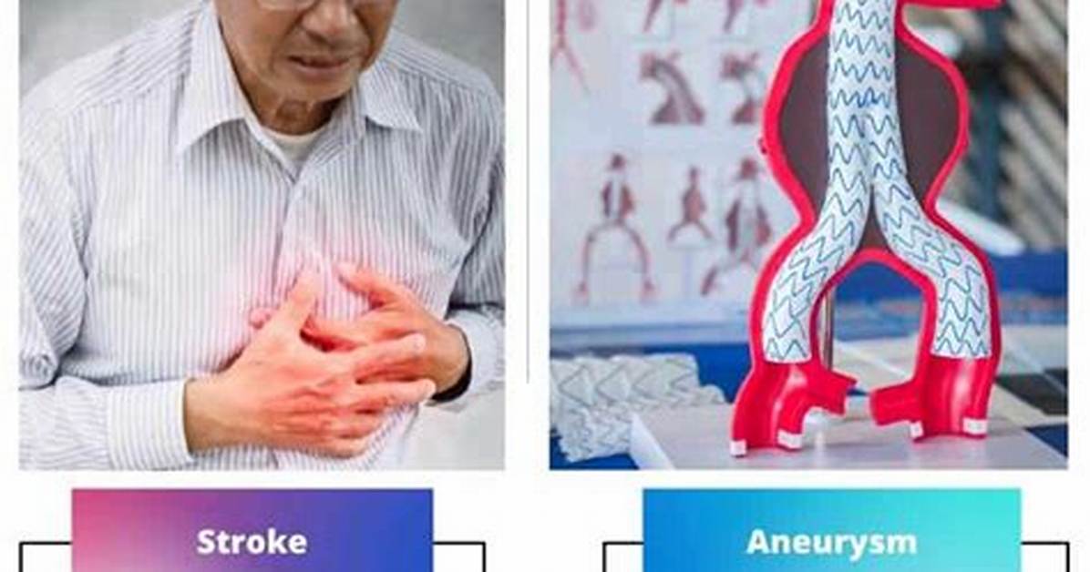 Stroke vs Aneurysm on Scans: How Doctors Spot the Difference Under Pressure