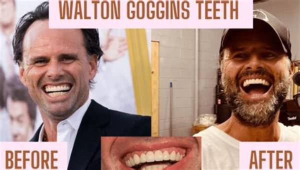The Brutal Truth Behind Walton Goggins' Teeth: How He Lost Them Twice