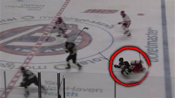 The Hockey Puck Incident: How an Nhl Game Ruptured Mia Khalifa's Breast Implant