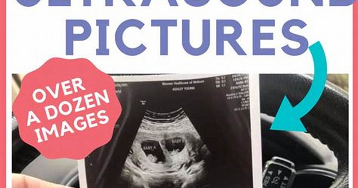 The Ultimate 7-Week Ultrasound Prep Guide: What to Eat, Drink, and Expect
