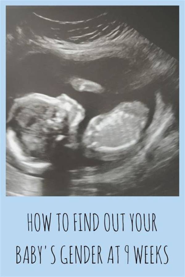 When Can You Find out Your Baby's Gender? How Accidental Clinic Leaks Ruin the Big Reveal