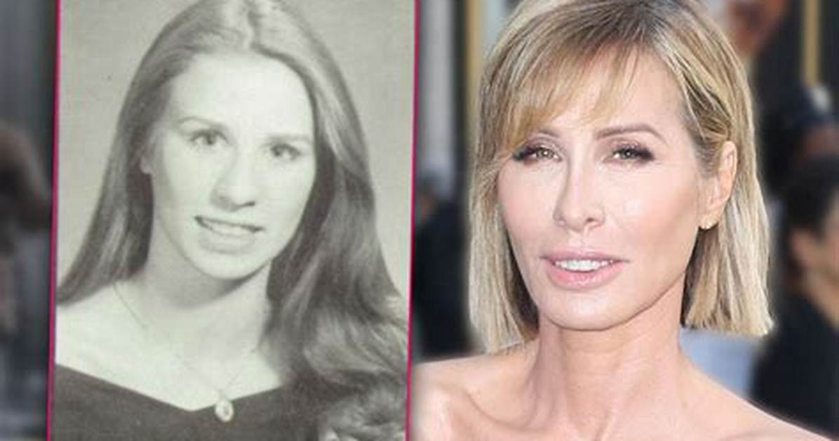 Young Carole Radziwill in Photos: Rare 90S Images from Abc News to Camelot Royalty